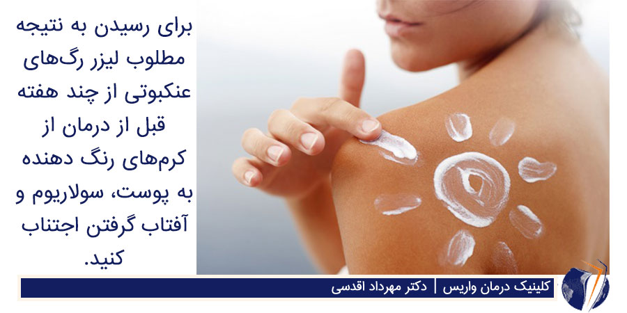 استفاده از ضدآفتاب برای محافظت از پوست و در نتیجه بهبود رگ های عنکبوتی