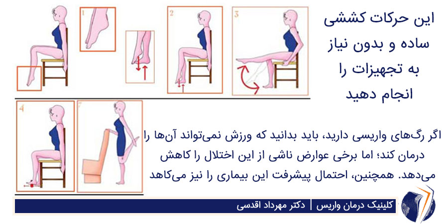 ورزش برای درمان واریس