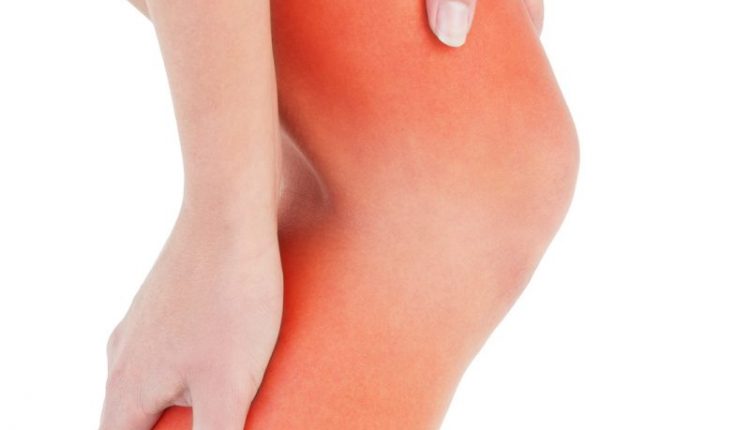 varicose