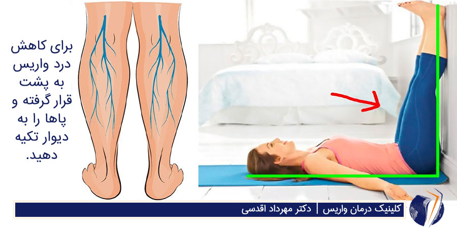 درمان خانگی واریس پا با ورزش