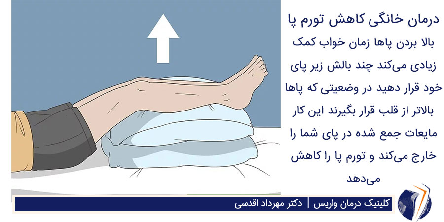 برای درمان خانگی تورم پا شبها موقع خواب چند بالش زیر پاهای خود قرار دهید و پا بالاتر تز سطح بدن قرار گیرد