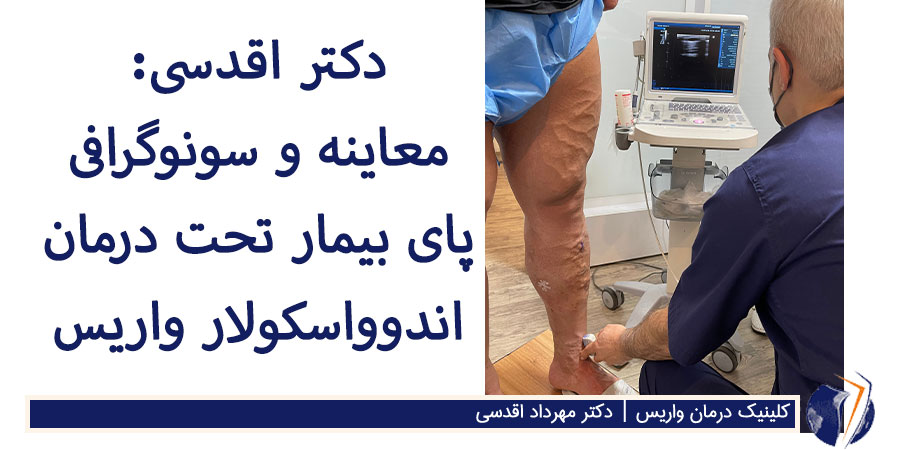 انجام سونوگرافی واریس