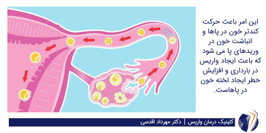 بالارفتن سطح هورمون پروژسترون از دلایل واریس بارداری