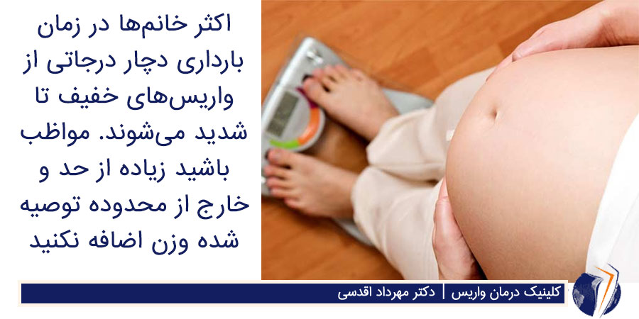 پیشگیری از واریس بارداری