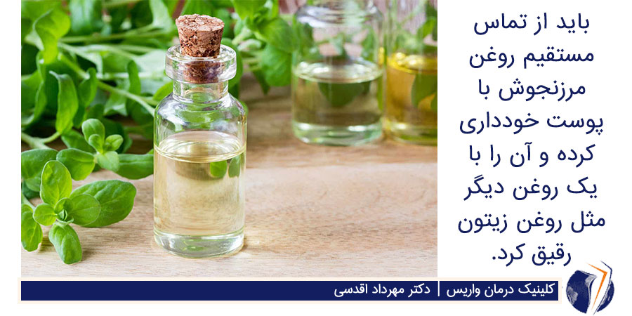 روغن مرزنجوش برای درمان واریس