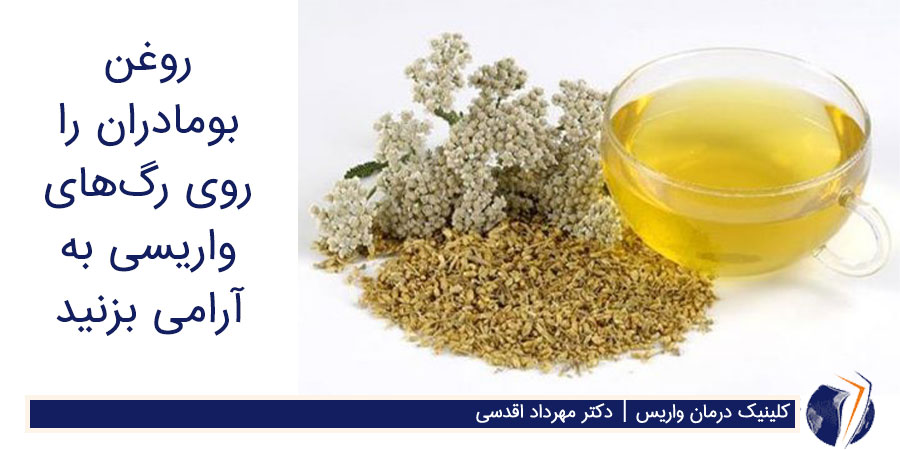 روغن گیاه بو مادران برای درمان واریس