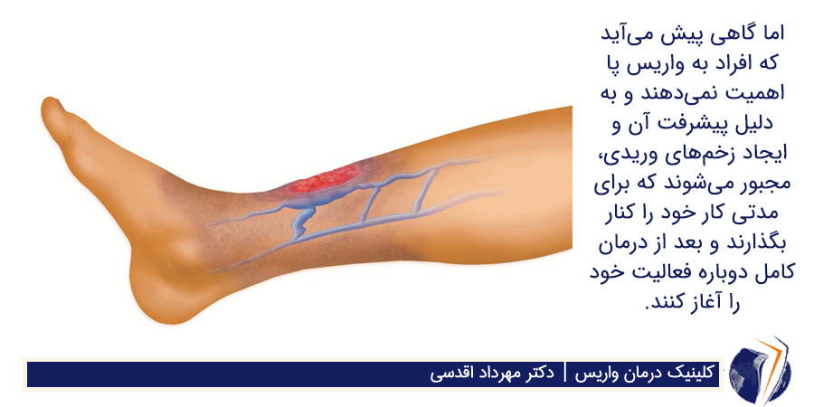 ایجاد زخم های وریدی