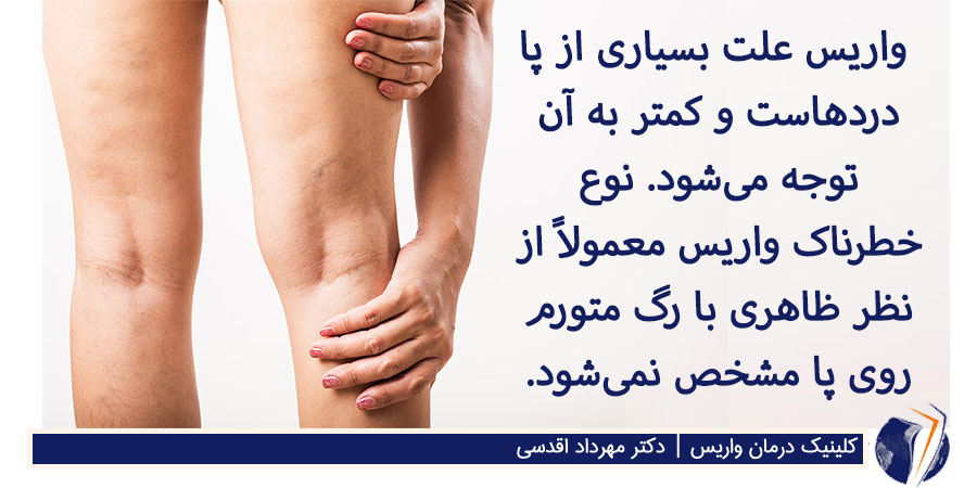 علت گرفتگی و درد ساق پا